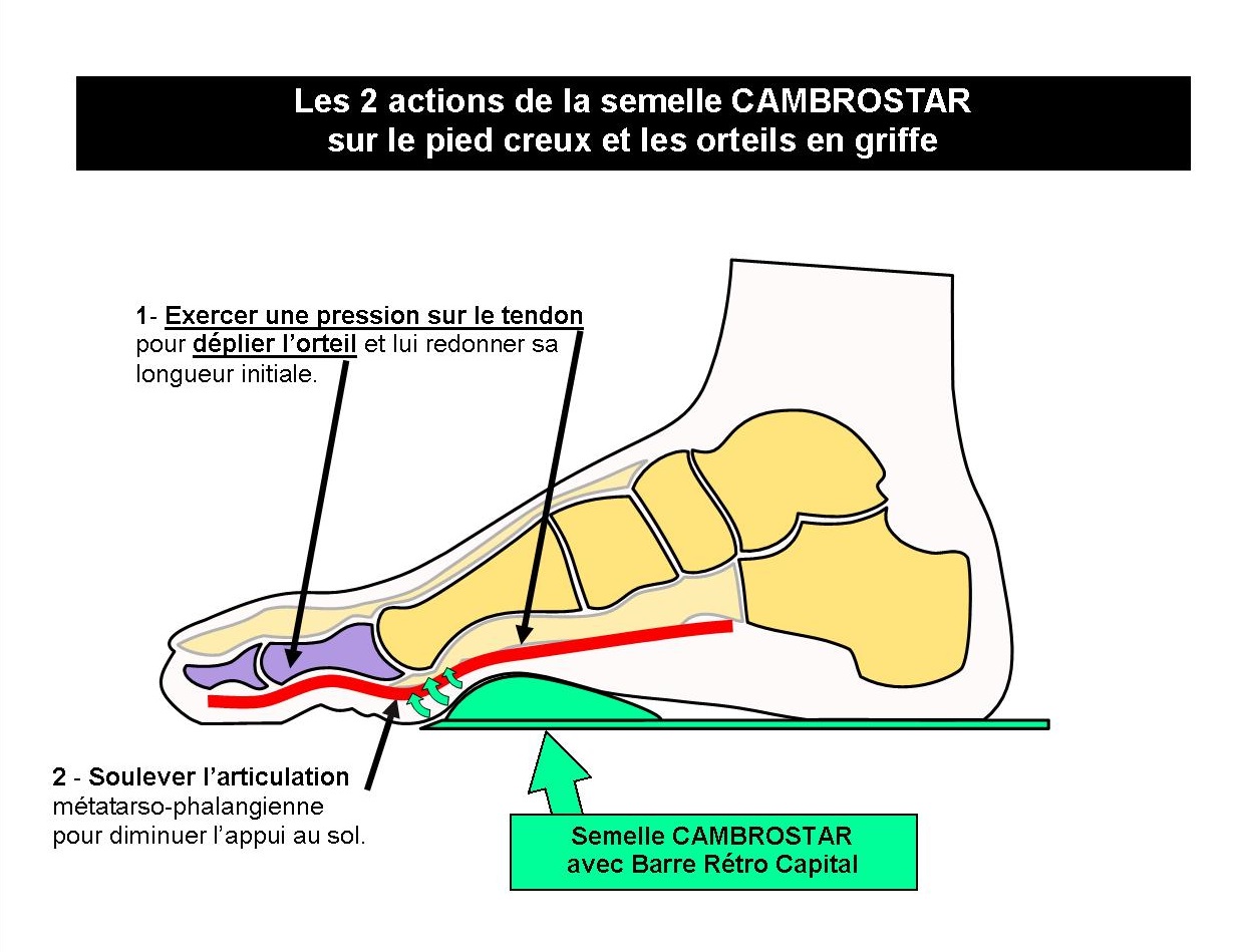 Semelle pour pieds creux new arrivals